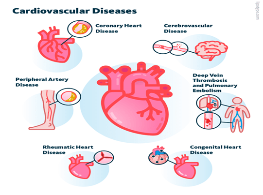 CARDIOVASCULAR DISEASES