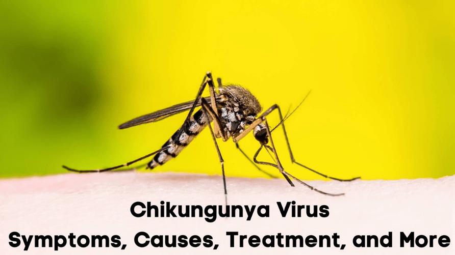 Chikungunya: Symptoms, Causes, Treatment, and&nbsp;Prevention